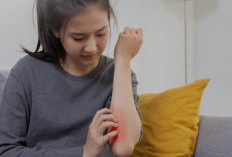 Waspadai 2 Gejala Penyakit Ginjal yang Bisa Muncul di Kulit